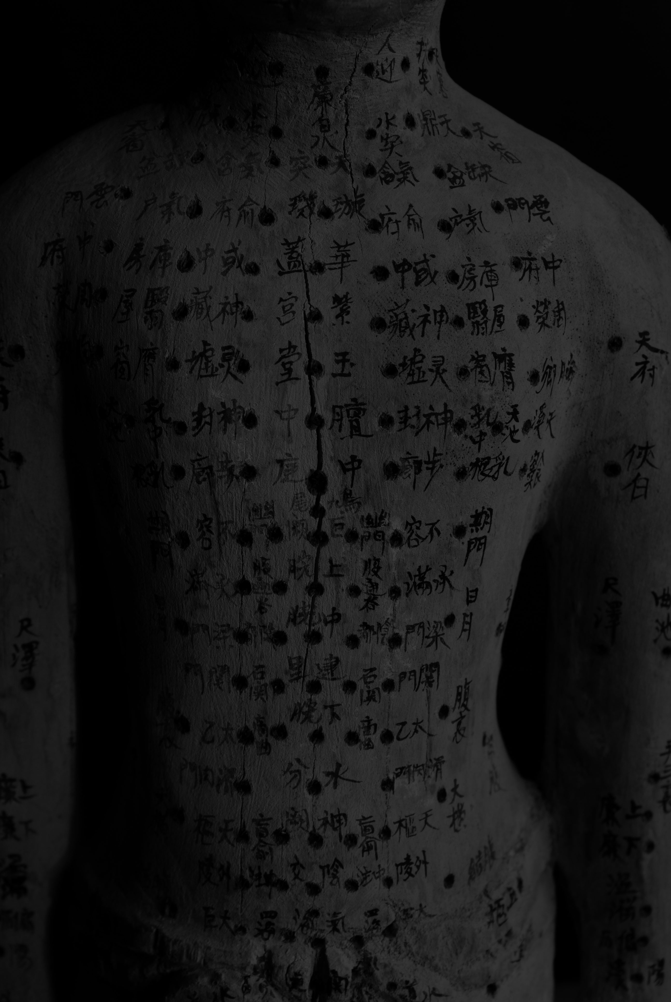 Acupuncture points